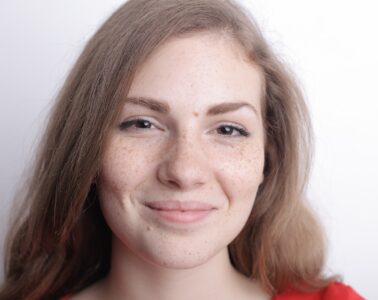 5 Ways to Protect Your Skin from Sun Spots