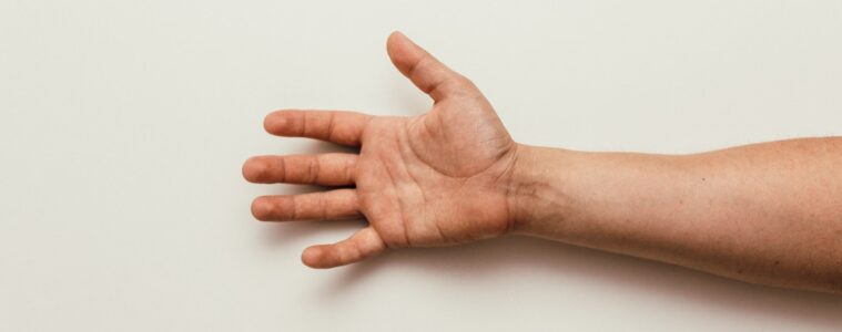 carpal tunnel surgery cost