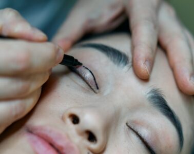 blepharoplasty cost